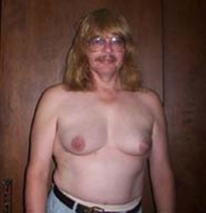 Men with female breasts