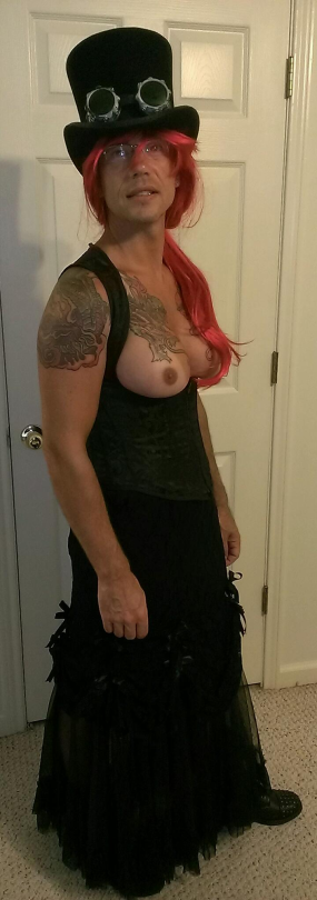 Men with female breasts
