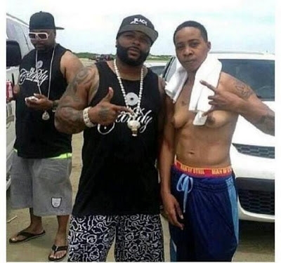 Men with female breasts