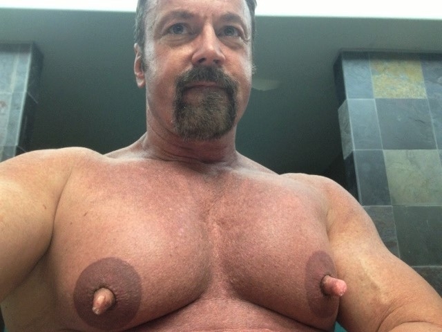 Men with female breasts