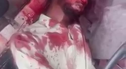 Three people were shot by Robbers for resisting